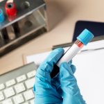 Ce înseamnă hemoleucograma? Analiza completă a sângelui